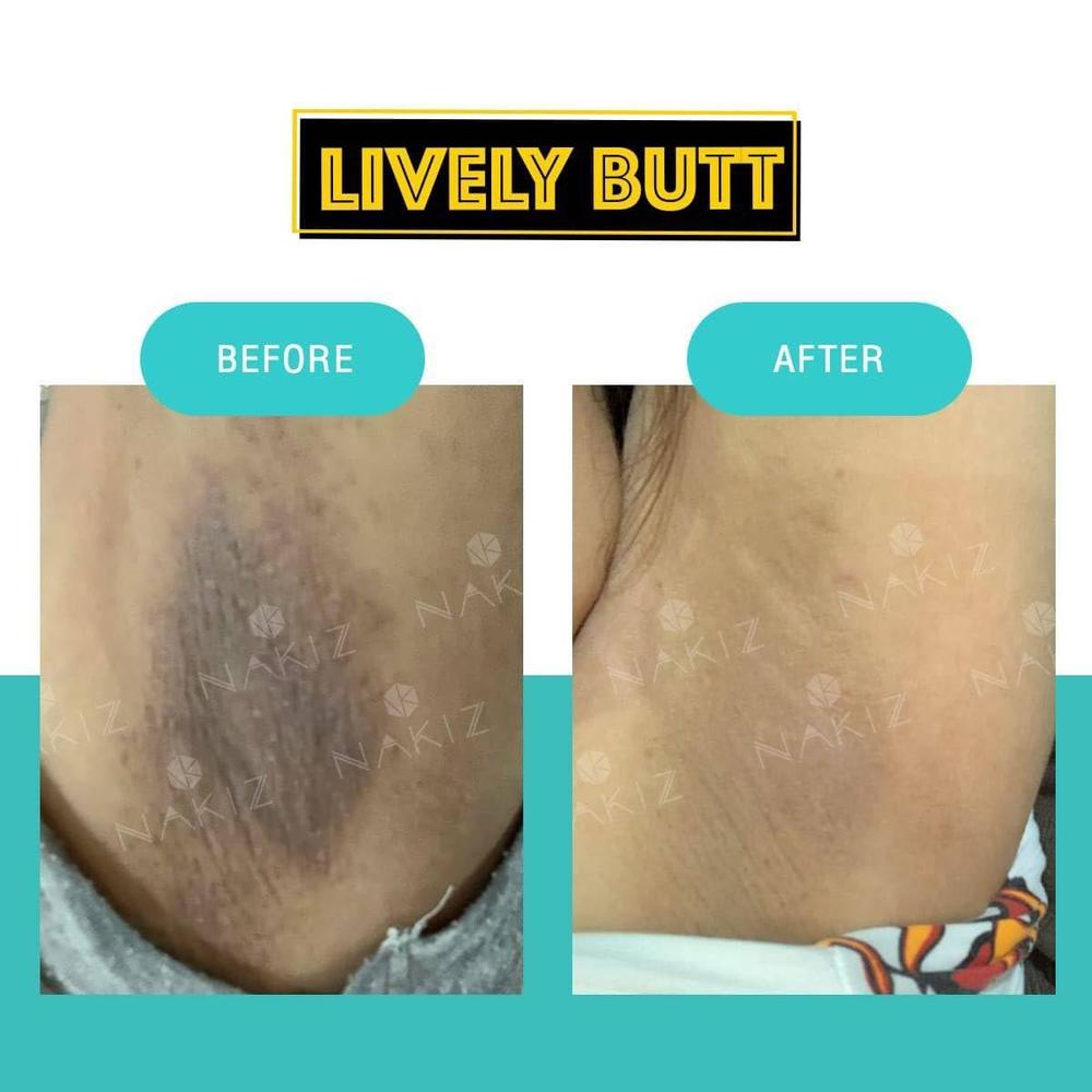 Nakiz Lively Butt Cream